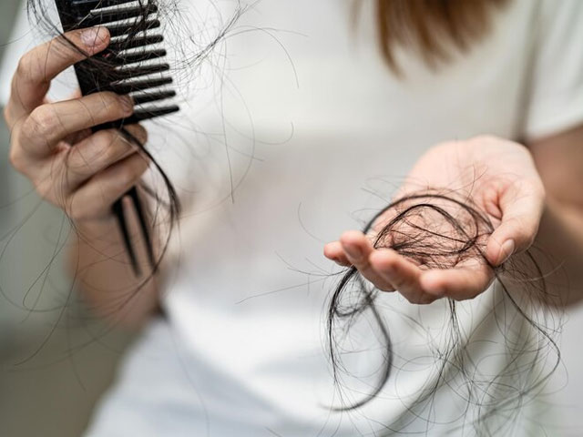 علل ریزش مو در نوجوانان