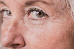 خشکی پوست دور چشم، راهکار هایی برای درمان آن